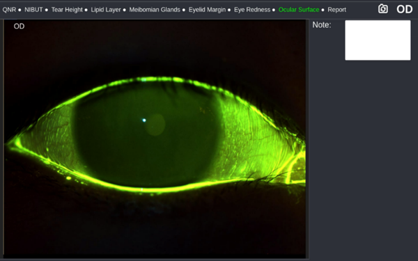 Ocular Surface