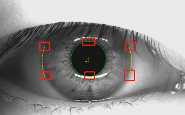 Pupil&Cornea